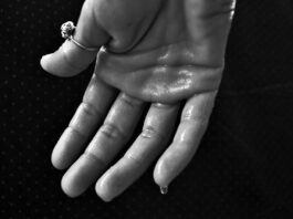 Prakaituoja rankos ir pėdos. Prakaituotos rankos.